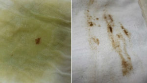 Мажет после мазков