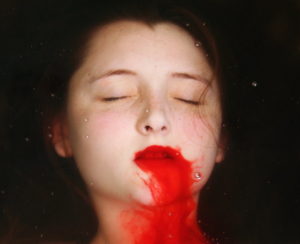Кровь из горла