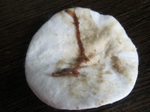 Коричневые выделения 31й день цикла