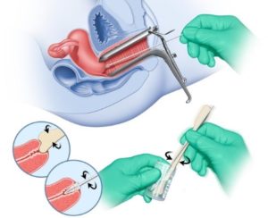 Мазок после секса