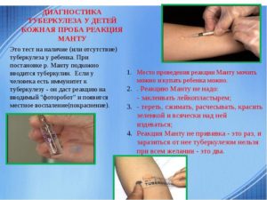 Манту при простуде