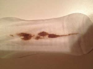 Коричневые выделения 31й день цикла