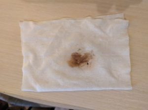 Коричневые выделения при беременности