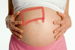 Каменный живот