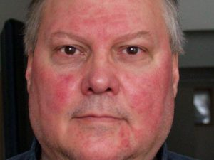 Краснеет лицо и тело после употребления алкоголя