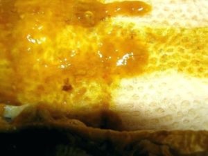 Креон. Слизь в стуле