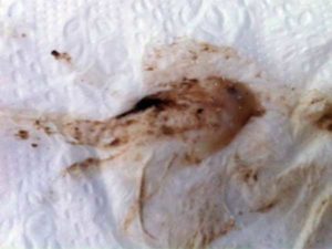 Коричневые выделения и зуд после менструации