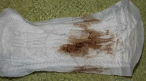 Кровяные выделения в течении месяца