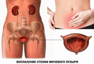 Боль внизу живота после секса