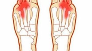Болит палец безымянный на правой ноге при ходьбе, обувь свободная