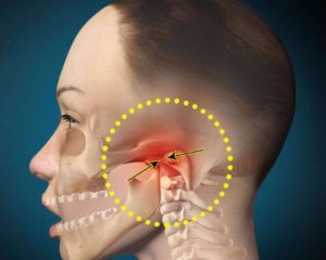 Болит кость лица