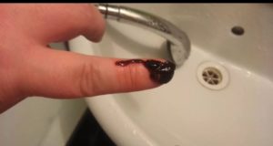 Первые месячные идут 9 дней