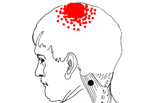 Болит голова сзади вверху (впервые)