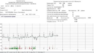 Ктг. Помогите разобраться с поправкой на сон