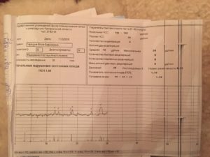 Ктг. Помогите разобраться с поправкой на сон