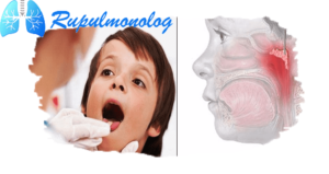 Кашель и аденоиды у ребёнка