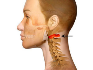 Болит голова, нестабильность в отделе С2