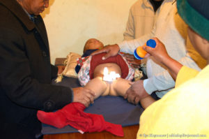 Как остановить кровотечение после обрезания